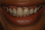 Dental Case presentations for Dentists
