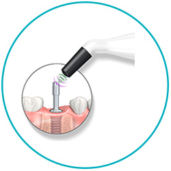 Dental product - Penguin RFA