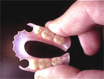 Valplast partial denture