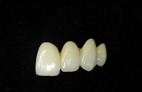 Procera Zirconia